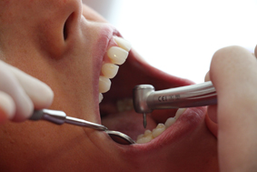 Endodoncia