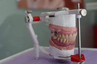 Prótesis Dental