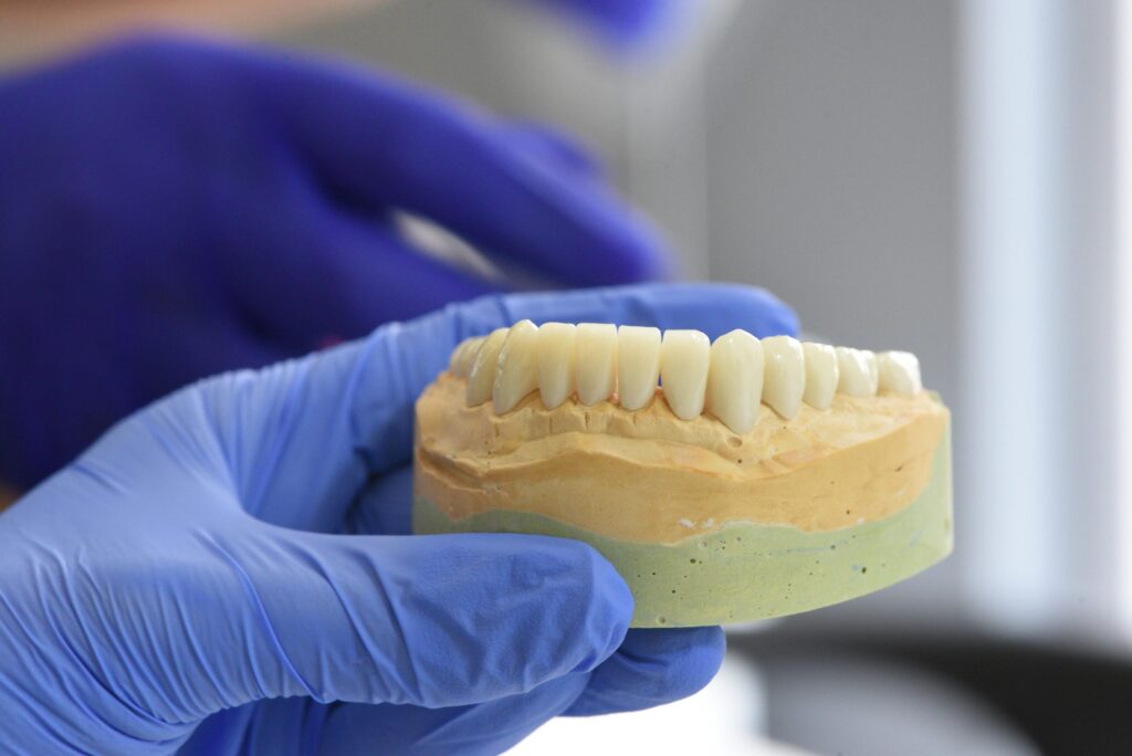 Implantes